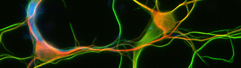 Microtubules and Transport inside Neurons (MTTN 2023)